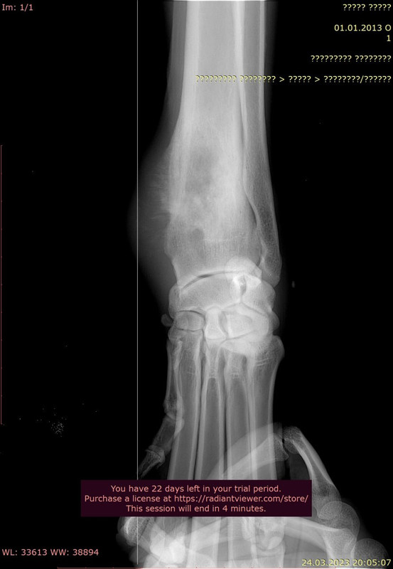 ляшко шейла