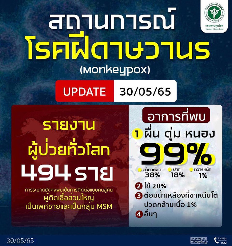 Update กรมควบคุมโรค รายงานสถานการณ์โรคฝีดาษวานรทั่วโลก