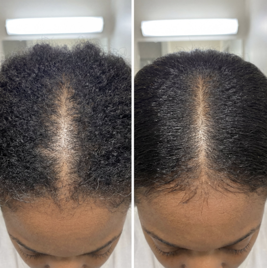 Résultat baby hairs