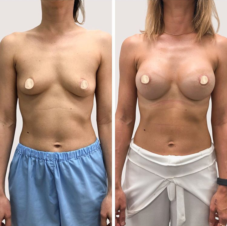 74CBCC64-4077-439A-B2A2-E08270DFDD4A