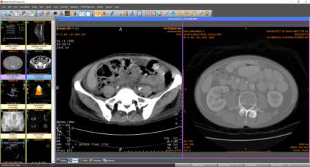 Sante DICOM Viewer Pro 11.9.4