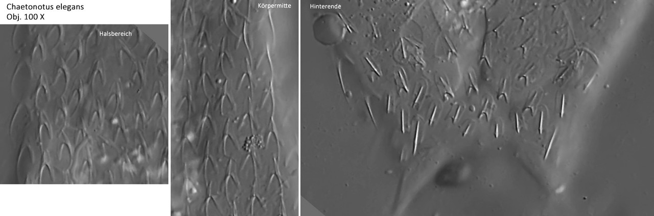 Chaetonotuselegans-PB133640-Kopie