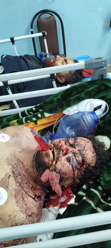 ۲۰۲۶۰۱۲۴ ۱۹۲۸۲۸