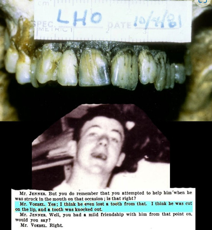 oswalds-teeth-and-voebel.jpg
