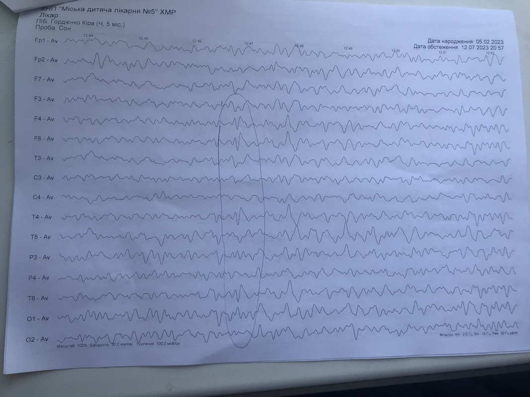 354F6E45-1151-419E-BC56-61037D491CE7