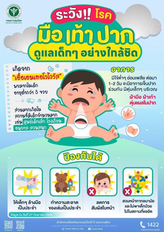 โรค มือ เท้า ปาก