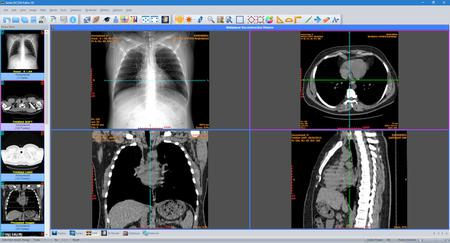 Sante DICOM Editor 3D 4.9.4 Portable