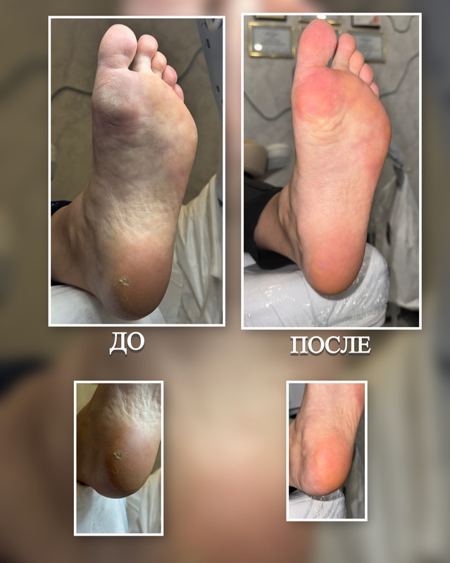 подология новая 1