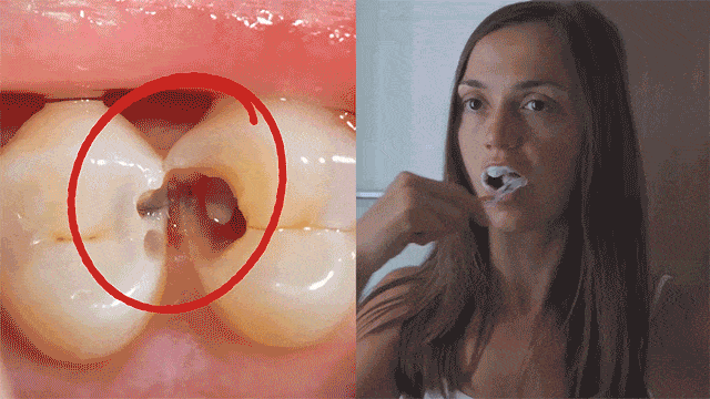 Natural Gum Disease Cure