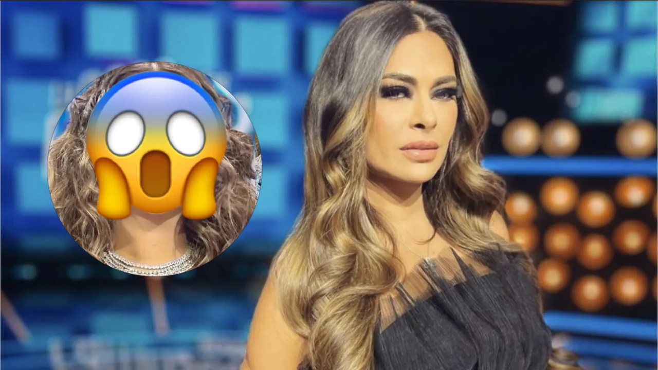 ¿Qué le pasó en la cara? Galilea Montijo se realiza arreglos estéticos y acaba mal