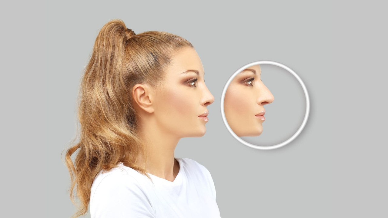 Millennials ¿Cuál es la cirugía estética que más desean?