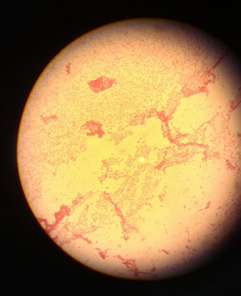 Escherichia-Coli.png