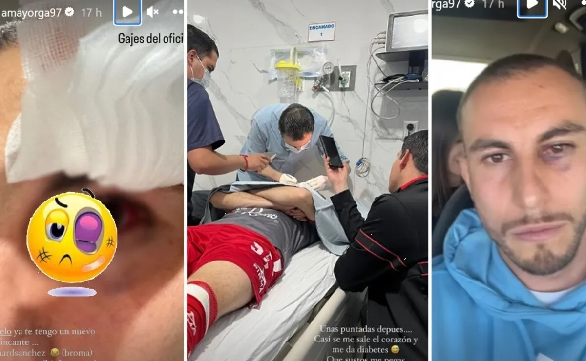 Alejandro Mayorga publica fotos de su ojo tras golpe de Richard Sánchez