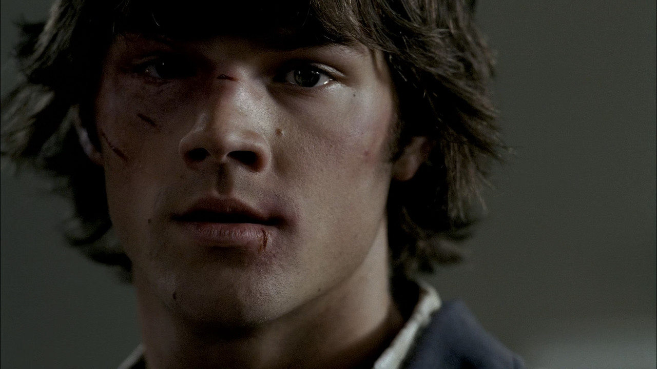 Supernatural (2005) - S02E01 - In My Time of Dying (1080p BluRay