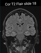 Screenshot 20251108 122000 Chrome 2