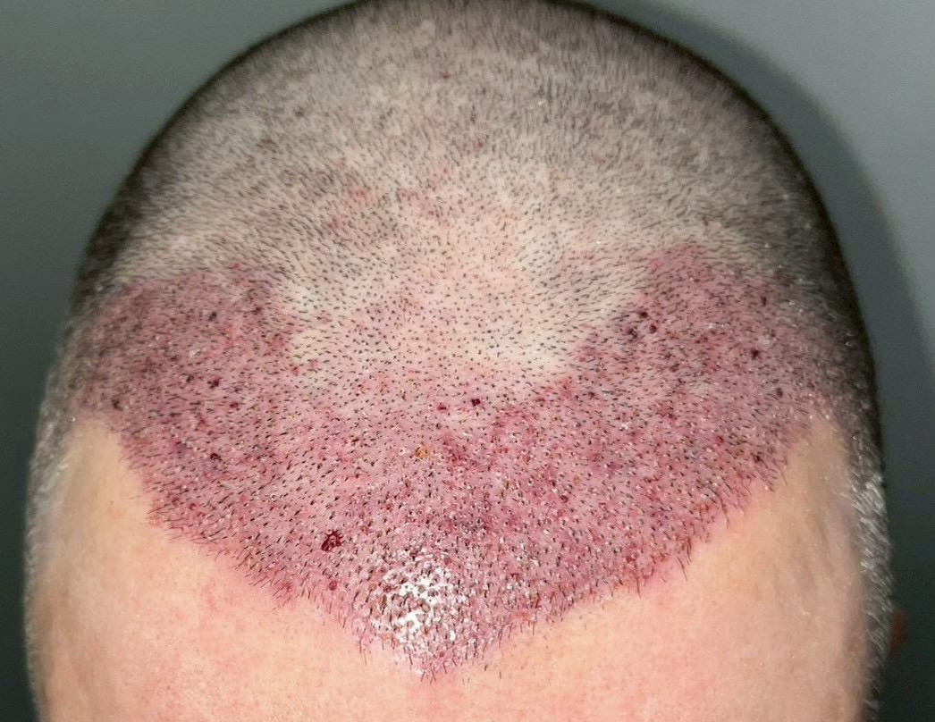 eba8e368 4a8f 45f3 9a56 cb928446c8f0