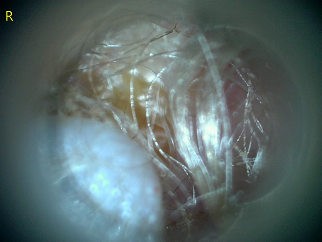 23207 177213 Into CNS 000006