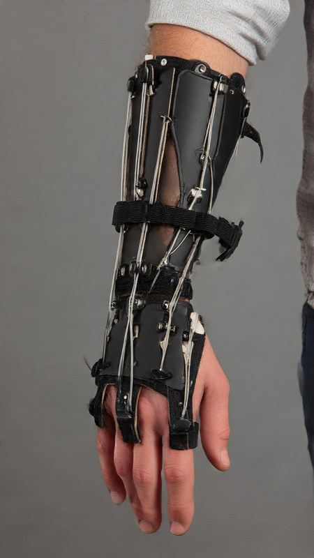 Upper limb orthotics