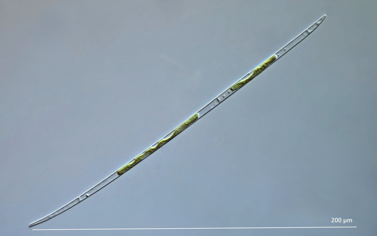 Closterium 51 (ev) limneticum Spindel-Alge Lenz I-43 DIK 100 Potzenberg