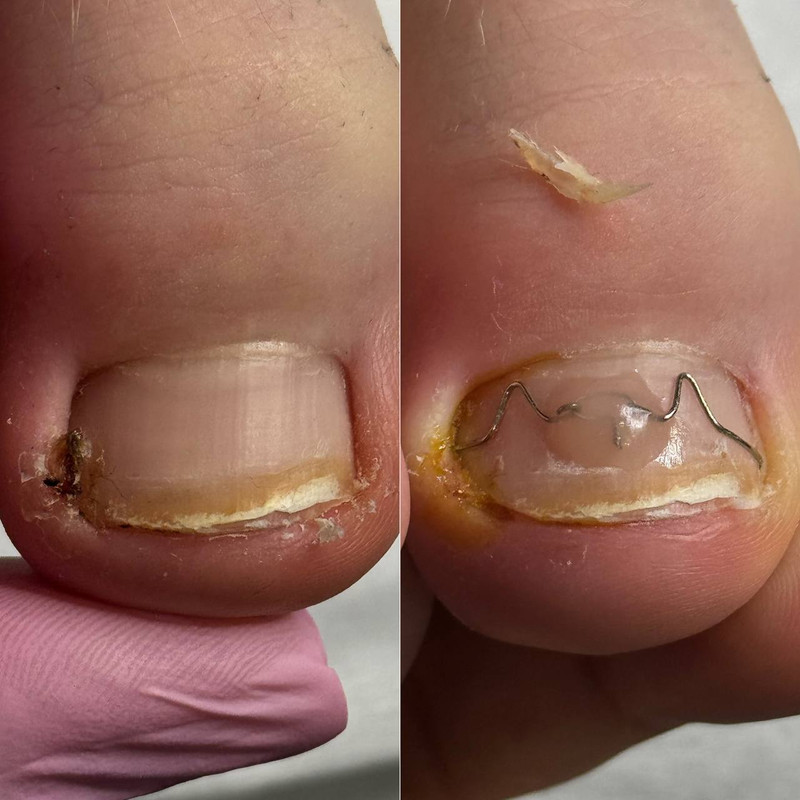 подология 5