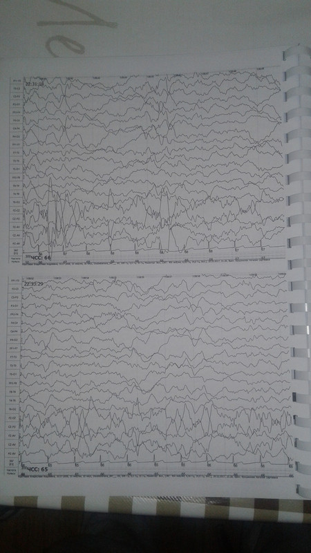 1510522721035-321866249