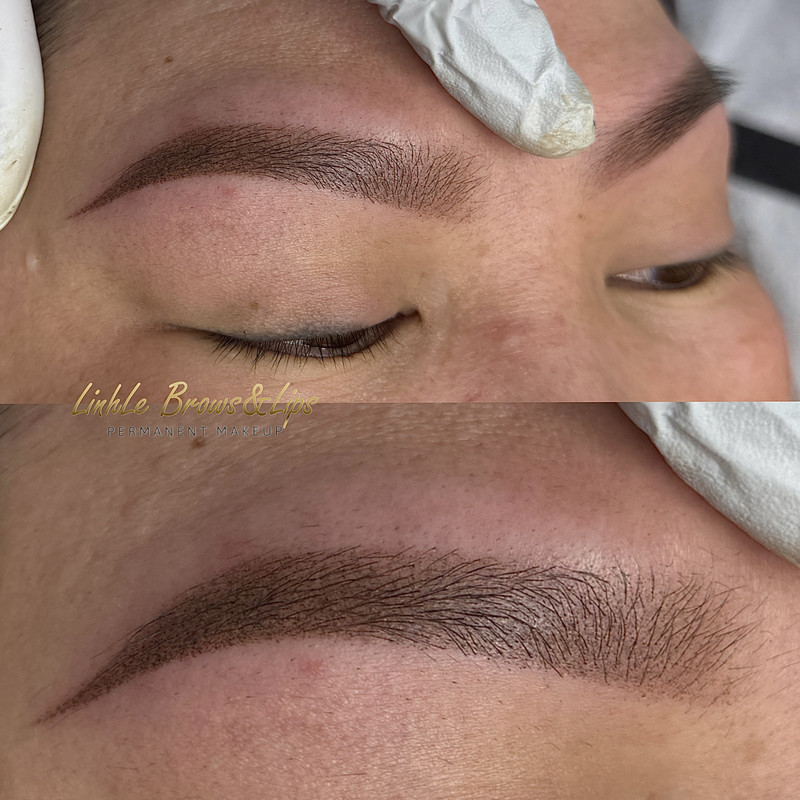 Eyebrow Enhancement Example 3