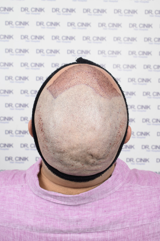 photos postopératoires (5)