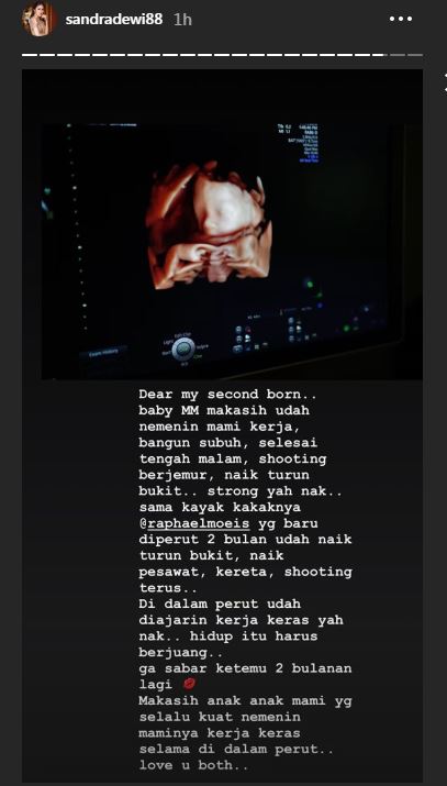 Instagram/sandradewi88