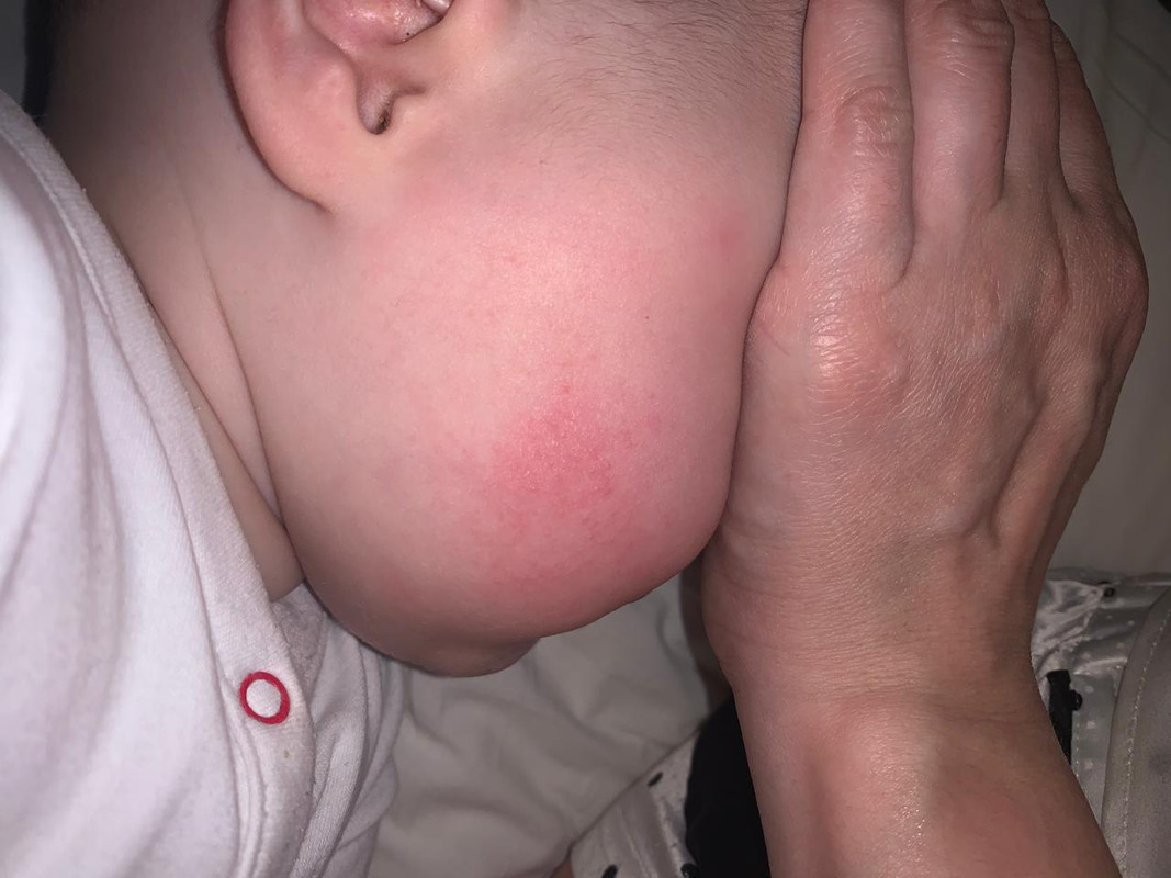 AB78318F-DD75-4D9C-A75E-B11D23189E68