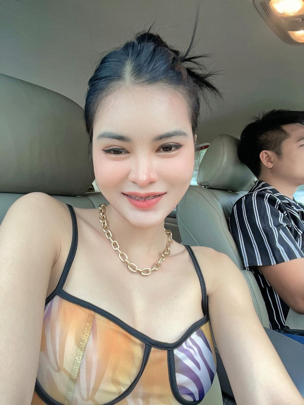 ct_20220721015855803