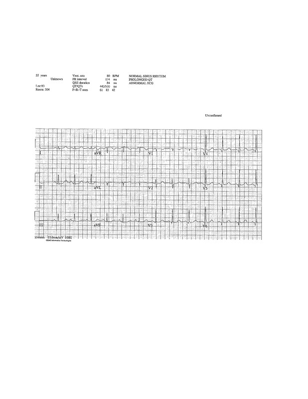 Susan EKG Prolonged QT 3 — Postimages
