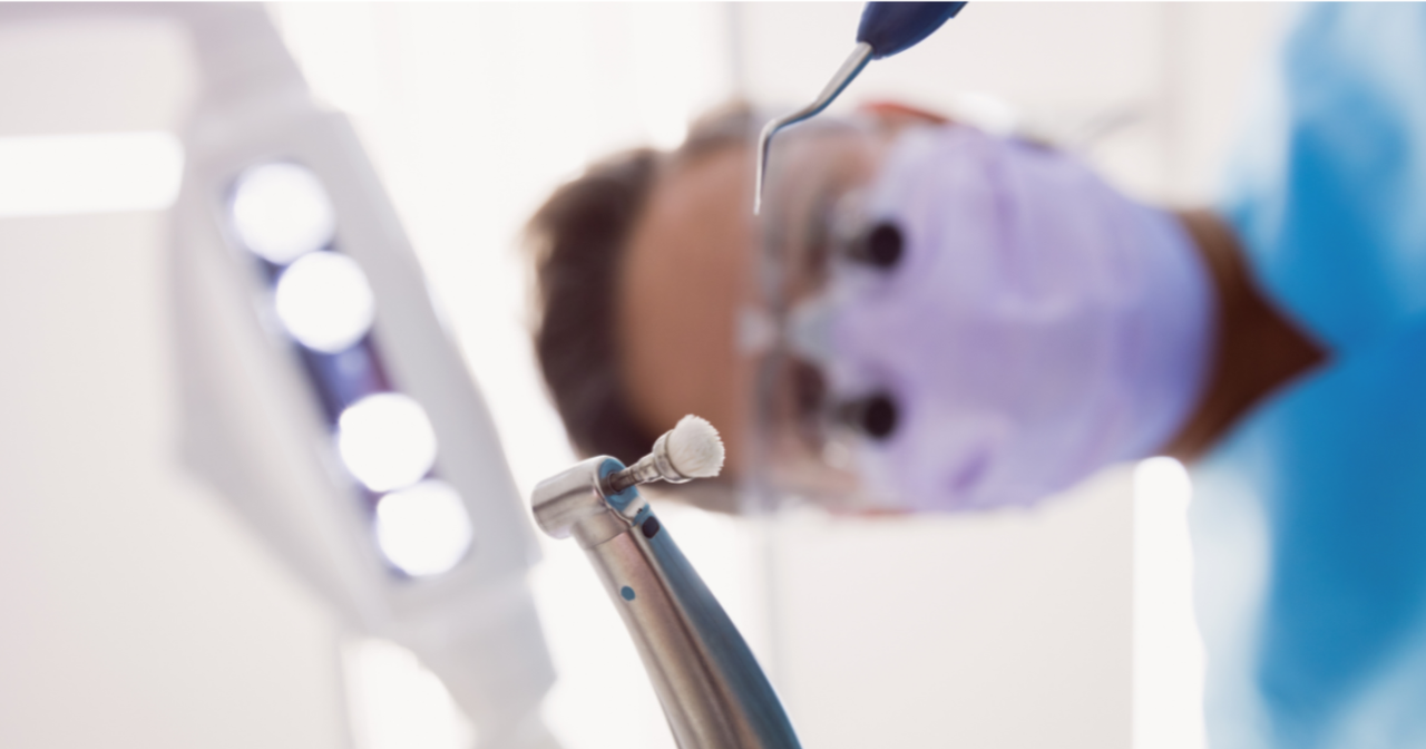 5 facts you need to know about teeth whitening