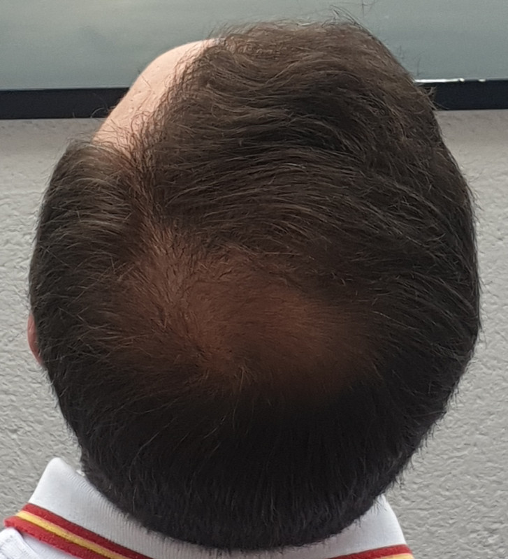 Point Blur_Apr132020_194102