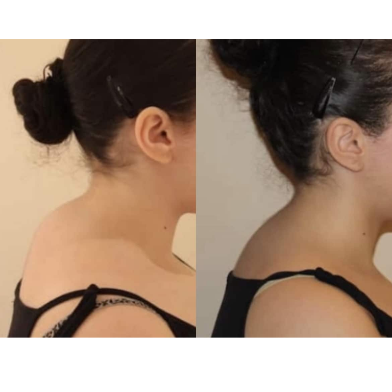 Avant / Après posture