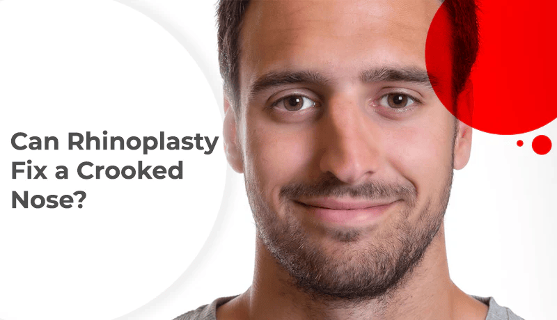 [Image: can-rhinoplasty-fix-a-crooked-nose-1.png]