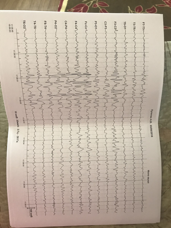 D78CB677-AEBB-47C7-AA07-7DC1F49E7766