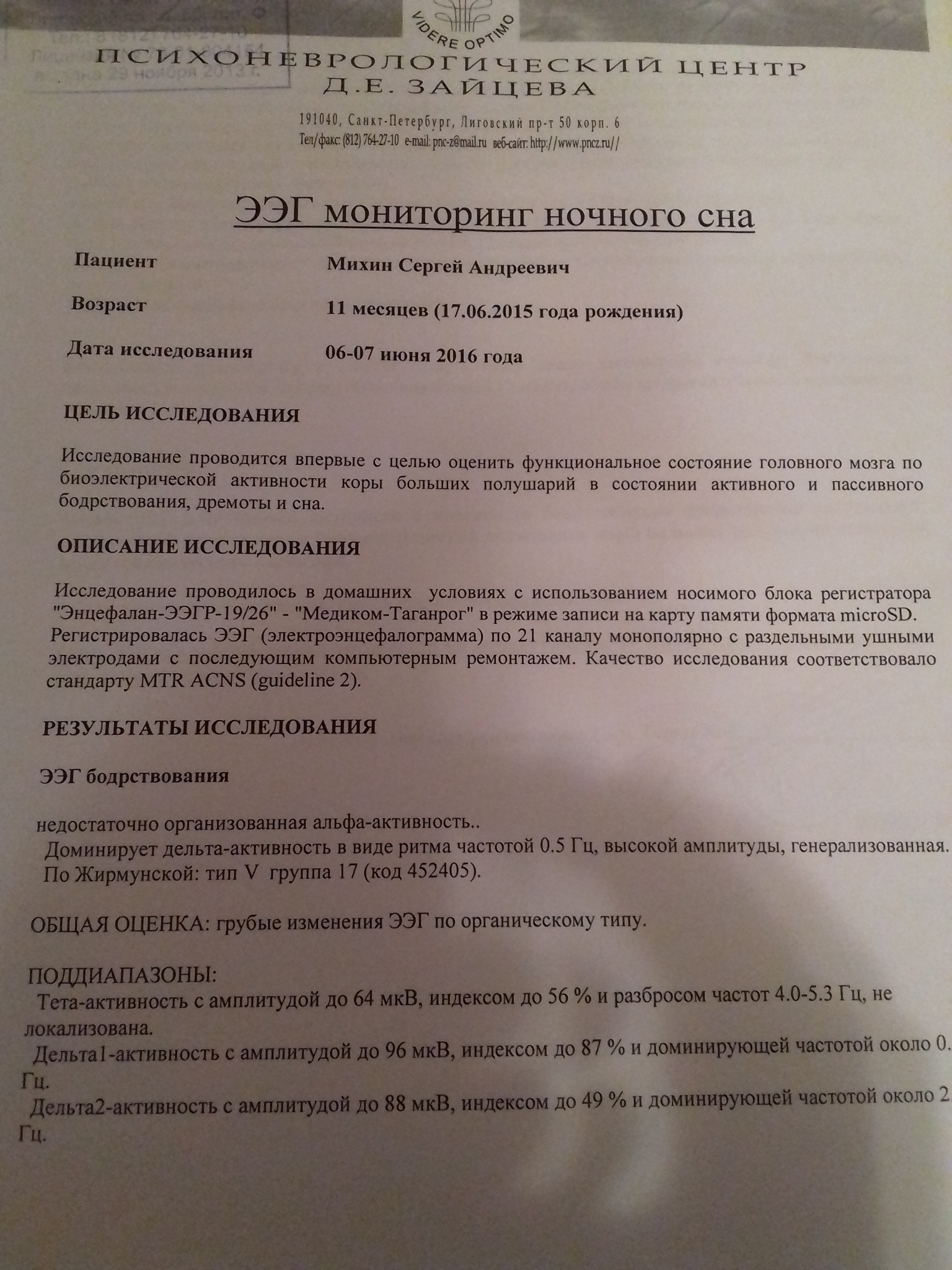 ЭЭГ головного мозга заключение норма