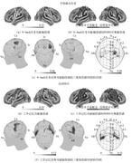 图 3-10 脑功能经颅图谱及运动执行功能 TBA（Jiang et al.，2020）（见彩图 3-10）