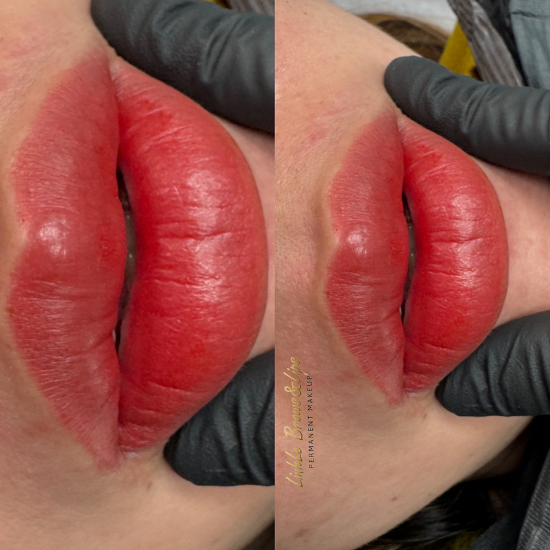 Lip Enhancement Example 3