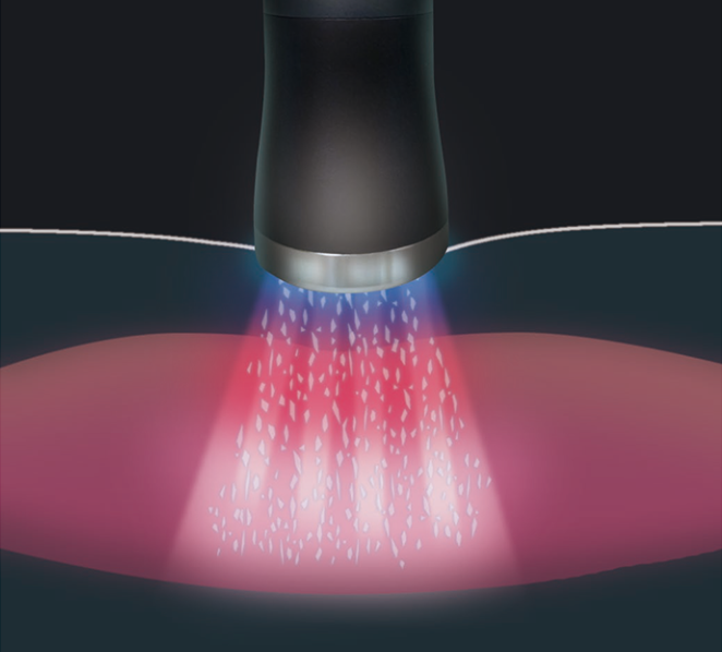 ハイボルテージとマイクロカレントの波形図