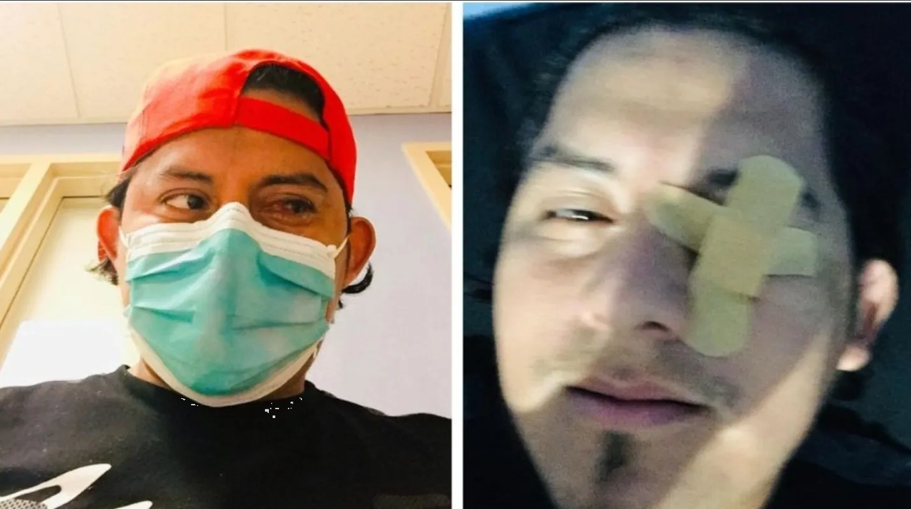 Hombre perderá un ojo tras ignorar advertencias y observar eclipse solar sin protección