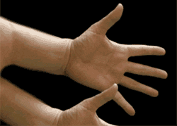 Dépossession charnelle