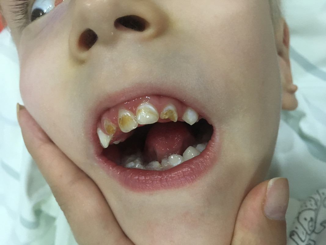 953BE512-6BFD-4188-8E5E-446AF3AA5F02