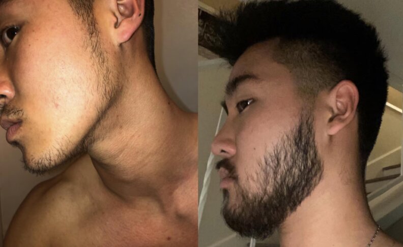 Antes y después de rutina capilar Crownix