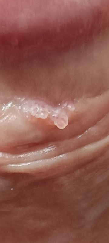 Screenshot 2026 01 01 21 31 23 060 com miui gallery