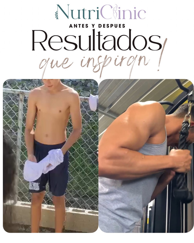 Resultado antes y después 2
