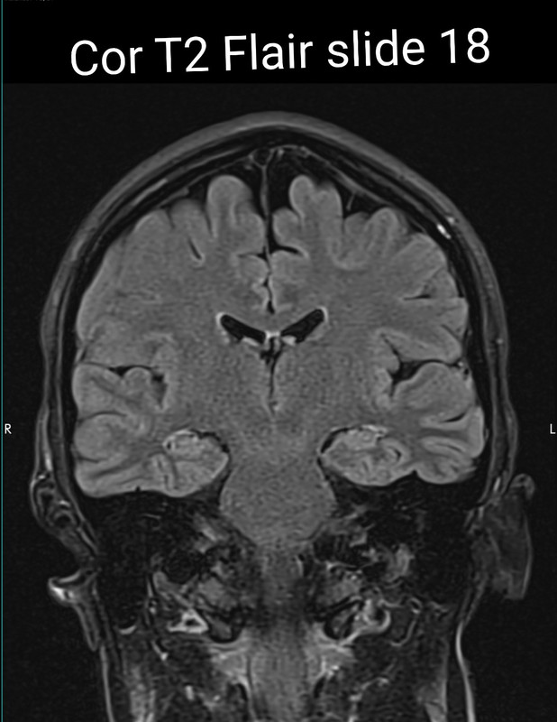 Screenshot 20251108 122000 Chrome 2