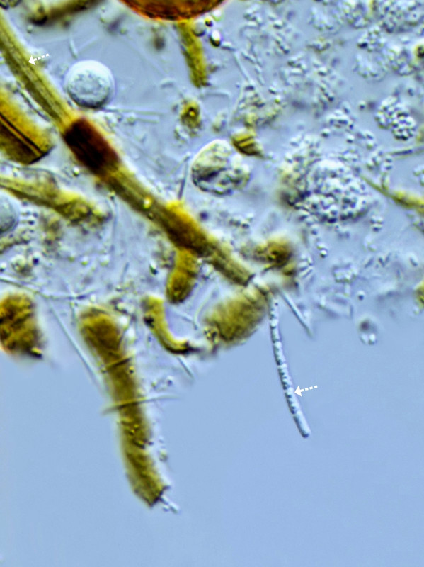 Bakterien 79 Leptothrix ochracea Ocker-Bakterium Zellen verlassen Schleimhülle DIK 100