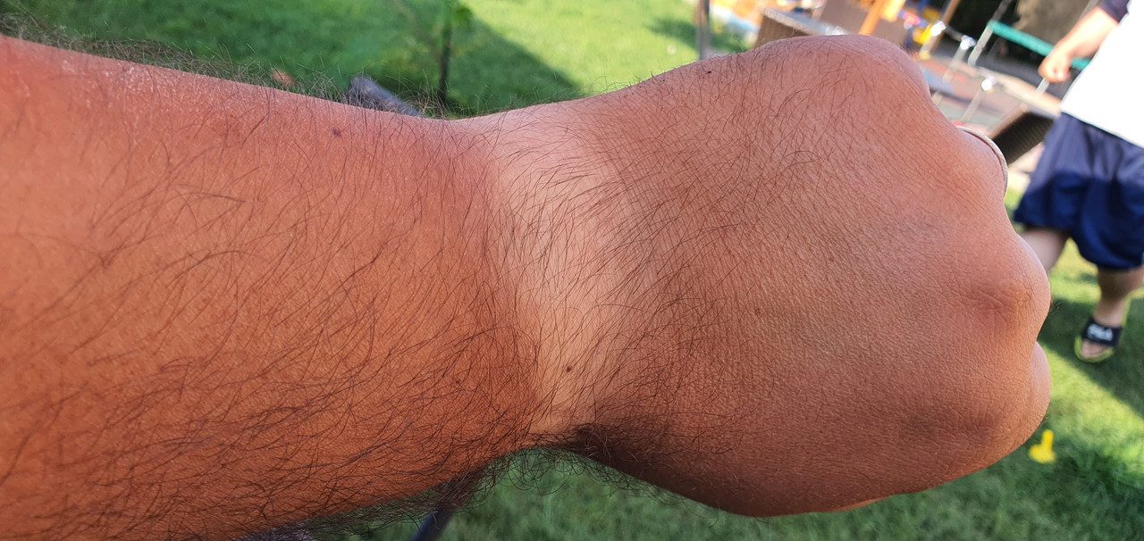 16277942502076617530874087324989