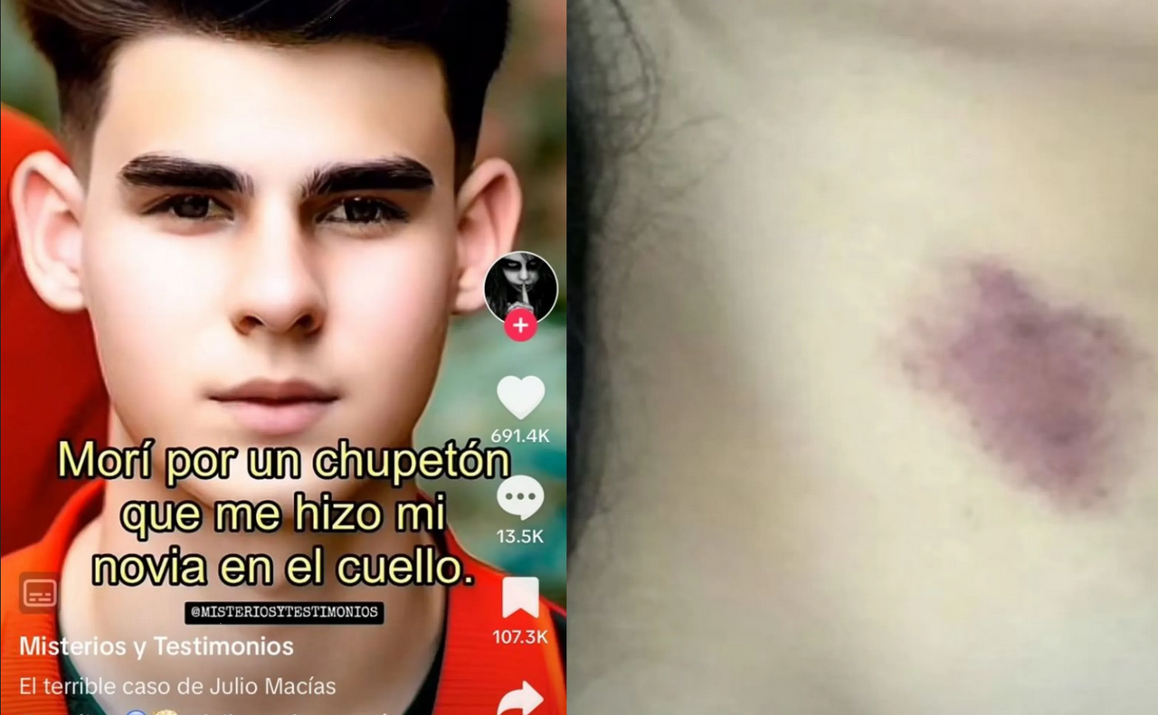Joven mexicano murió por un chupetón que le hizo su novia en el cuello